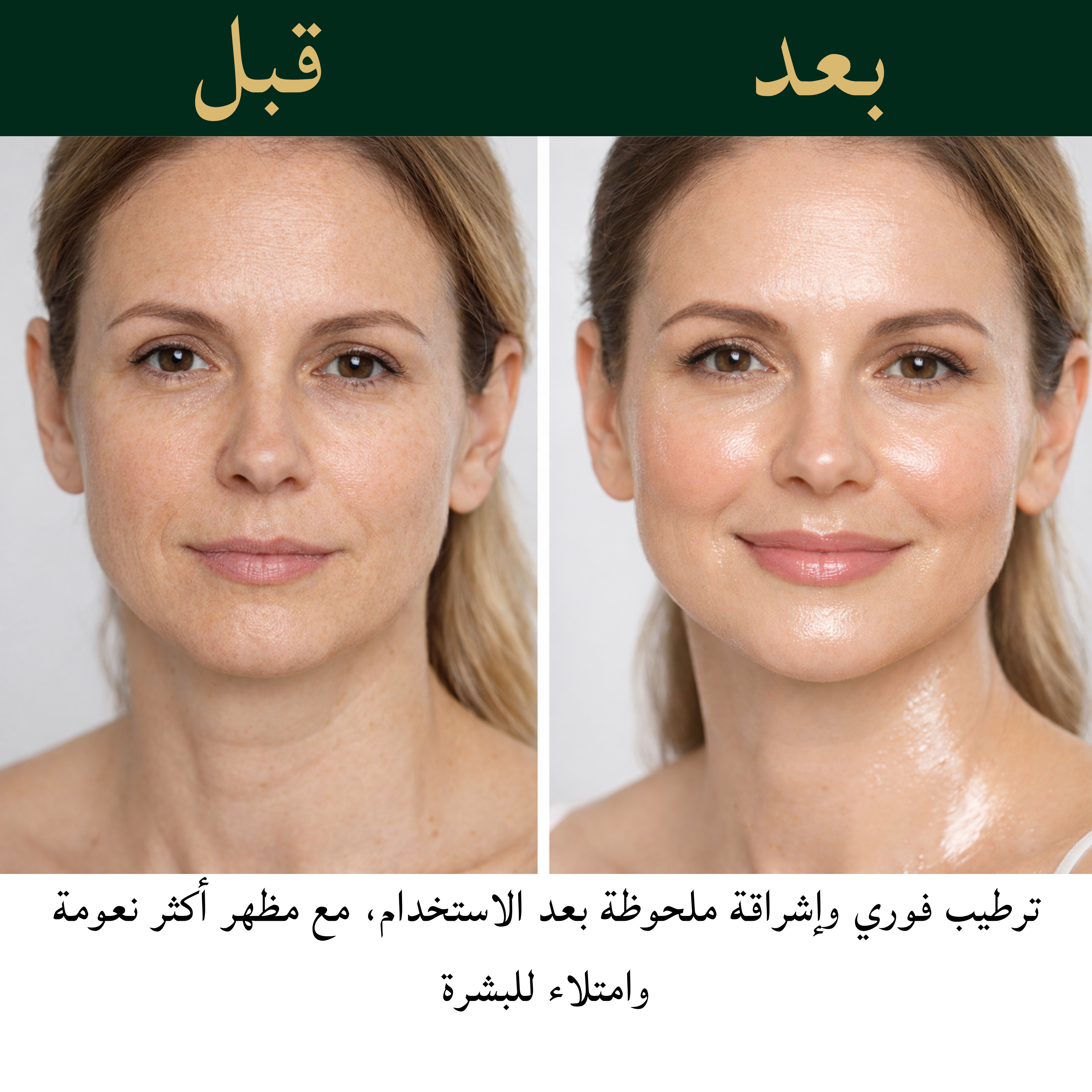 باندل الإشراقة والشدّ من OilTress