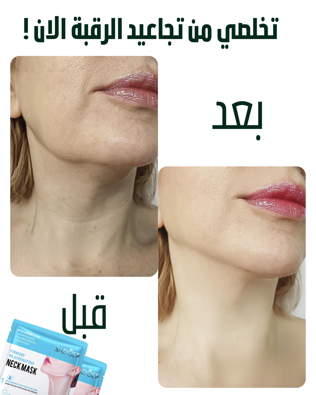 بكج رقبة الحرير